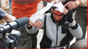 Gian nan nghề BLV bóng đá: Máu đổ mạng vong sau những dòng bình luận