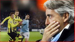Man City: Gã khổng lồ chân đất sét