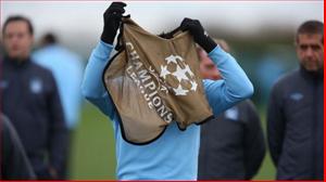 Bắt chước Balotelli, Scott Sinclair không thể mặc áo tập