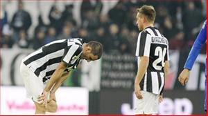 Juventus: Sau cơn địa chấn