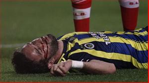 Cầu thủ bất tỉnh trong trận Fenerbahce thua Benfica