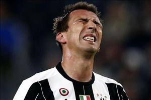 Juventus thiệt quân trước chuyến làm khách trên sân Lyon