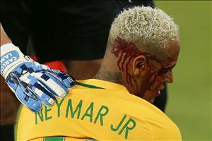 Đồ tể cho Neymar ăn cùi chỏ: Cậu ta xứng đáng bị như vậy!