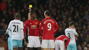 Vấn đề của M.U: Khi Mourinho không phải là bậc thầy tấn công