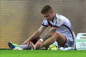 SỐC: Marco Reus CHÍNH THỨC bị loại khỏi ĐT Đức dự EURO 2016