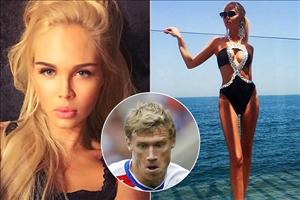 Vợ của danh thủ Nga bị chê là “bộ xương di động”