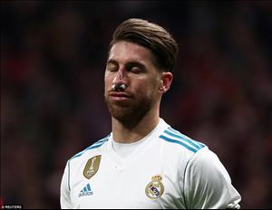 Trung vệ Sergio Ramos vỡ mũi sau trận derby Madrid