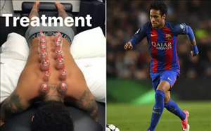 Neymar đi giác hơi trị liệu, chuẩn bị sẵn sàng cho màn tái xuất