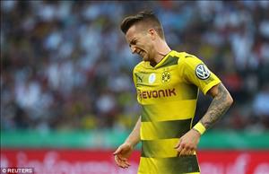 Giải khát danh hiệu, Marco Reus trả giá bằng đại hạn