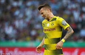 Marco Reus nỗ lực trở lại trong tuyệt vọng