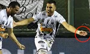 Cầu thủ Argentina dùng kim chọc đối thủ ngay trong trận đấu