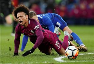 Pep báo tin cực buồn cho Man City