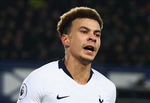Tottenham cập nhật hình hình chấn thương của Dele Alli