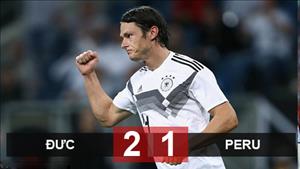 Đức 2-1 Peru: Chiến thắng may mắn
