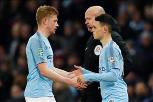 Guardiola cảnh cáo thái độ của ngôi sao số một Man City
