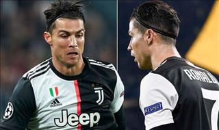 Ronaldo làm duyên thảm họa trong trận Juventus vs Atletico