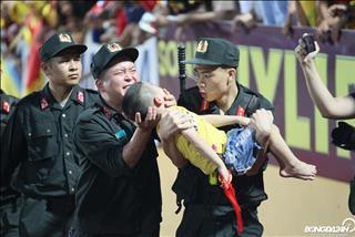 Nhìn lại những hành động cứu người thoát nuốt lưỡi trên sân cỏ Việt Nam