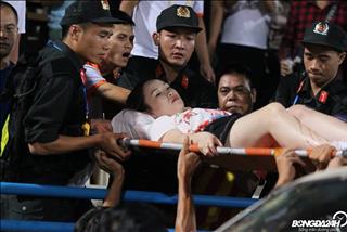 NÓNG: CĐV Nam Định làm loạn sân Hàng Đẫy, ném pháo làm một fan nữ bị thương