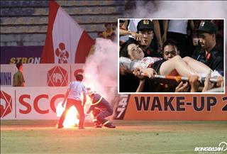 Video: Cận cảnh tình huống bắn pháo sáng khiến một nữ CĐV nhập viện