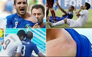 Ngày này năm xưa: Suarez hóa ác quỷ cắn trộm Chiellini