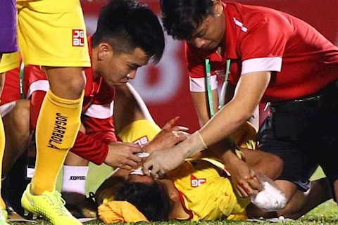 Sao Thanh Hóa phải khâu 9 mũi sau trận gặp Bình Dương