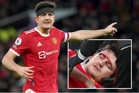 Harry Maguire đổ máu trong chiến thắng của MU trước Crystal Palace