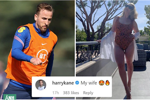 Vợ khoe thân mình khiến Harry Kane choáng váng