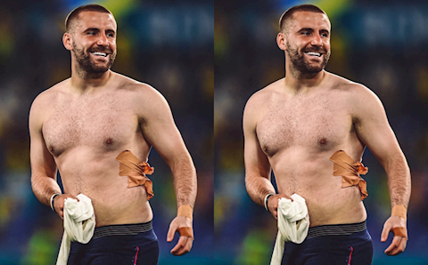 Luke Shaw tự tin bình phục trước mùa giải