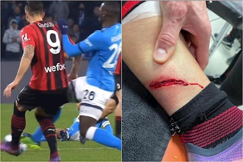Giroud dính chấn thương hãi hùng