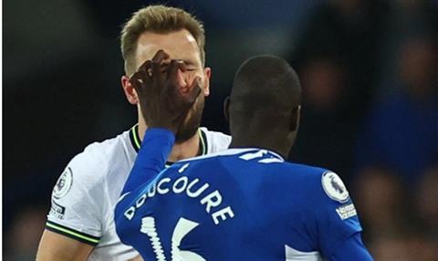 HLV Everton bất ngờ tấn công Harry Kane