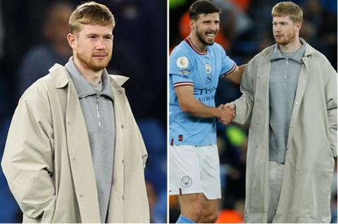 Hình ảnh lạ lẫm của Kevin de Bruyne