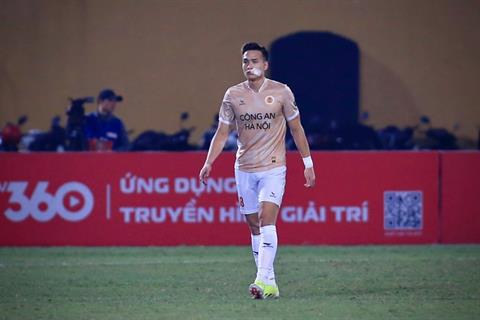 Bùi Hoàng Việt Anh vẫn có thể thi đấu sau chấn thương môi