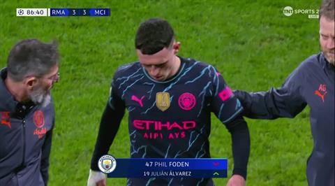 Pep Guardiola lên tiếng về chấn thương của Phil Foden