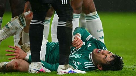 HLV Arne Slot lo ngại về cơn khủng hoảng chấn thương ở Liverpool