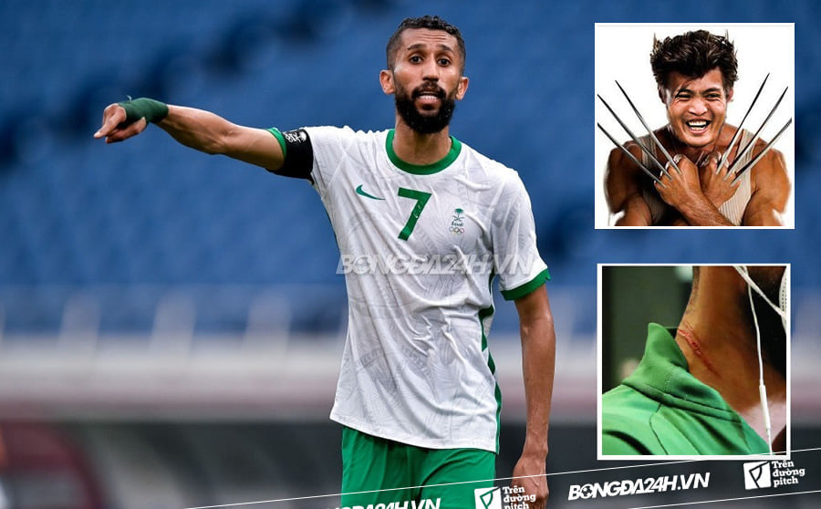 Tuấn Anh Tuấn Anh