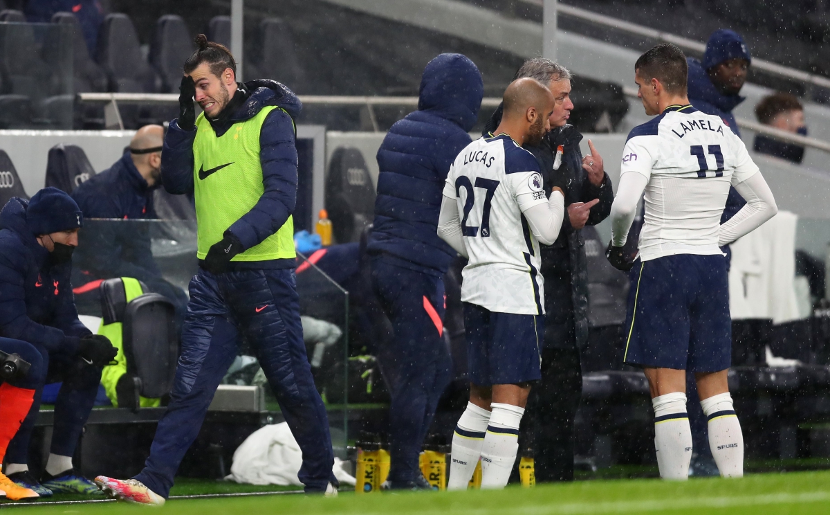 Xót xa với hình ảnh thảm thương của Gareth Bale hình ảnh