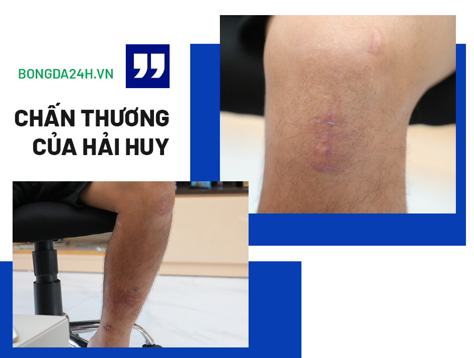 Hải Huy Nếu đánh mất chính mình thì làm gì còn cơ hội lên tuyển hình ảnh