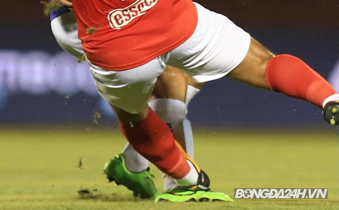 Cận cảnh chấn thương của Đỗ Hùng Dũng