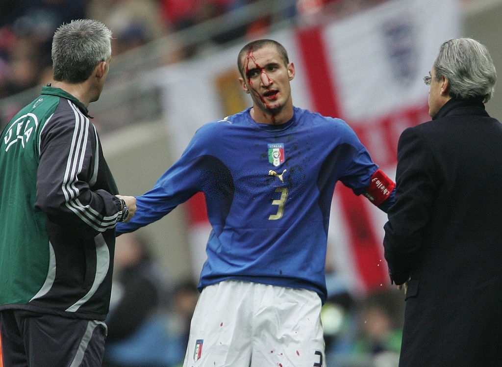 Giorgio Chiellini