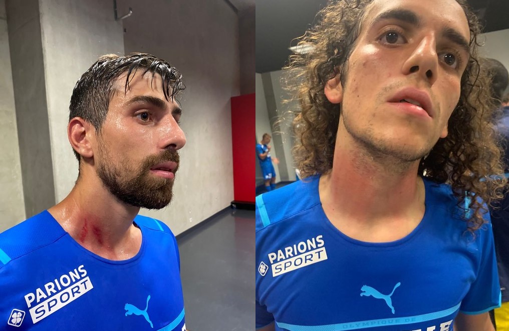 Các cầu thủ Marseille chấn thương ở màn hỗn chiến trên sân Nice