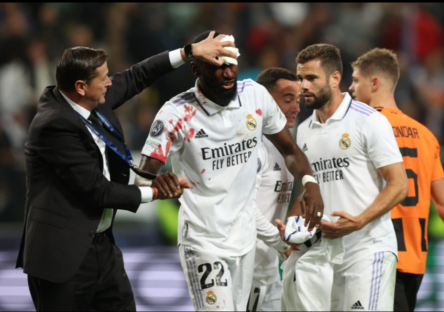 Antonio Rudiger khâu 20 mũi sau bàn thắng vào lưới Shakhtar Donetsk 2