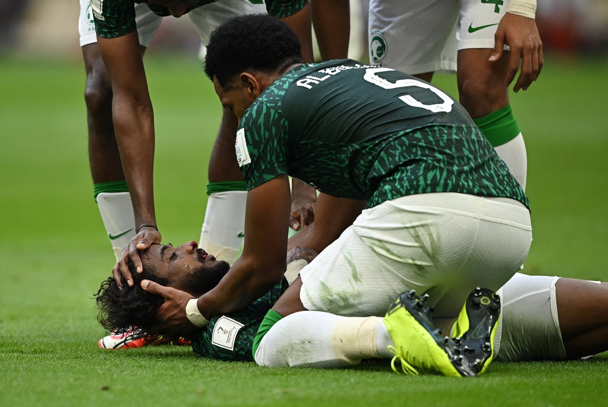 Thủ môn Saudi Arabia khiến đồng đội bất tỉnh trên sân 2