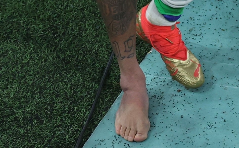 Cận cảnh mắt cá chân của Neymar 3