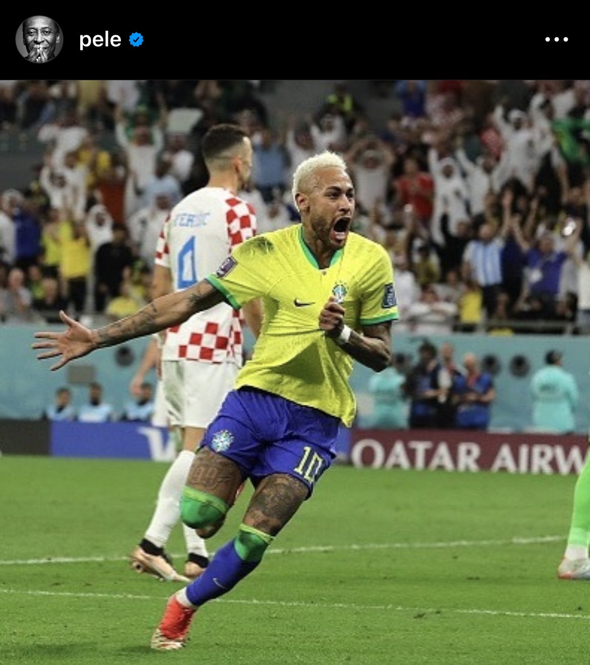 Trên giường bệnh, Pele gửi thông điệp tới Neymar 1