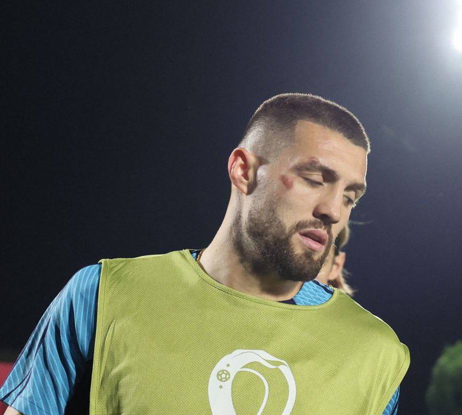 Sao Croatia dính chấn thương trong phòng gym 1