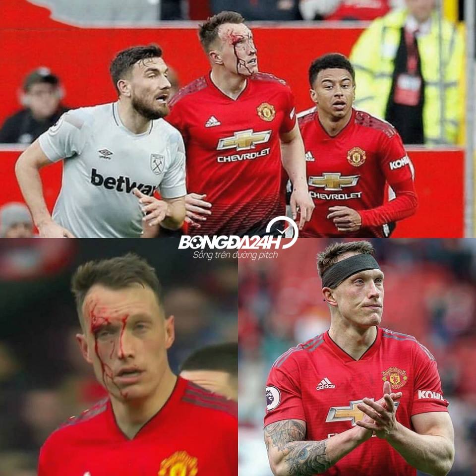 Phil Jones