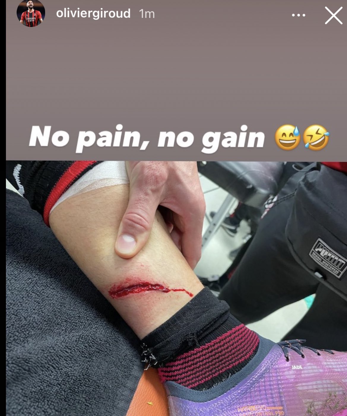 Olivier Giroud: Sóng trước chưa bị xô đổ