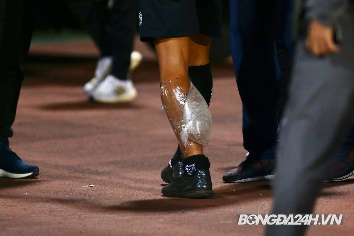 Sự cố hy hữu Trọng tài chấn thương trong trận Viettel vs Nam Định 8