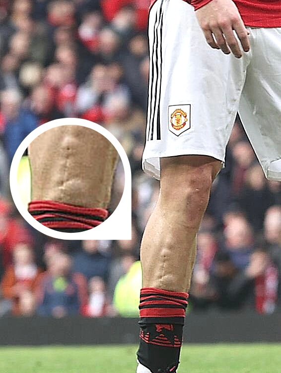 Luke Shaw để lộ hình ảnh khiến fan MU xót xa 1