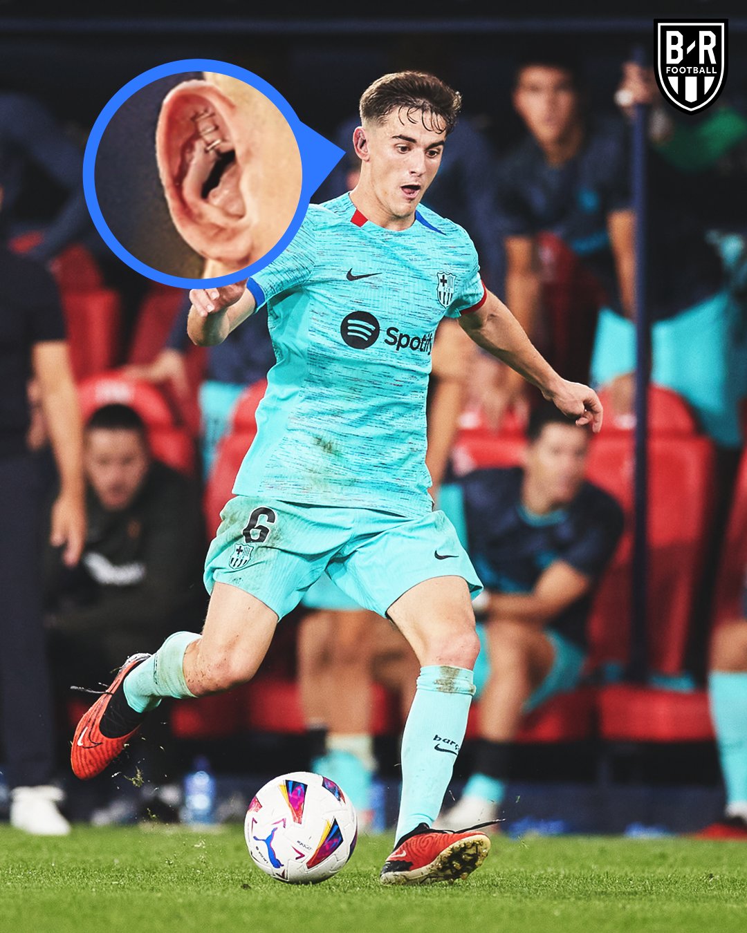 Gavi rách tai vẫn nén đau thi đấu cả trận cho Barca 1 Gavi rách tai vẫn nén đau thi đấu cả trận cho Barca 1